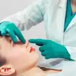 tratamiento de rinomodelacion nariz mujer