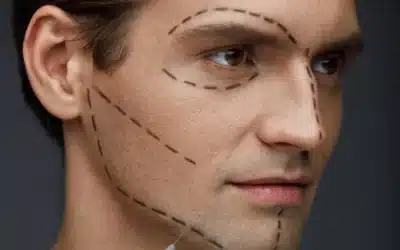 Masculinización facial: Guía completa